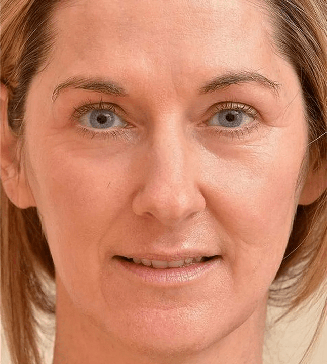 I look more yr after using Eudalie Cream