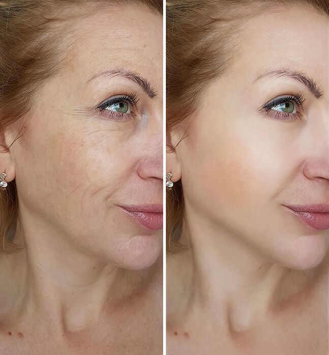 before and after