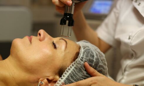 fractional thermolysis for rejuvenation